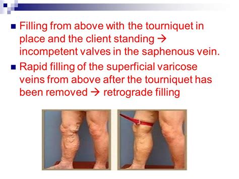 manual compression test veins|peripheral venous exam procedure.